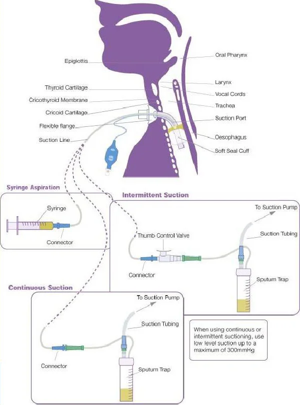 气囊压力监控仪